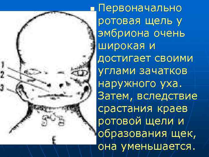 n Первоначально ротовая щель у эмбриона очень широкая и достигает своими углами зачатков наружного