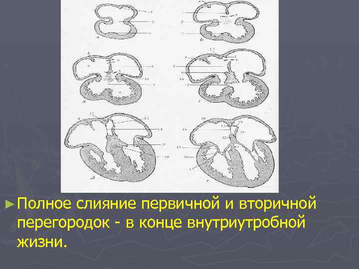 ► Полное слияние первичной и вторичной перегородок - в конце внутриутробной жизни. 