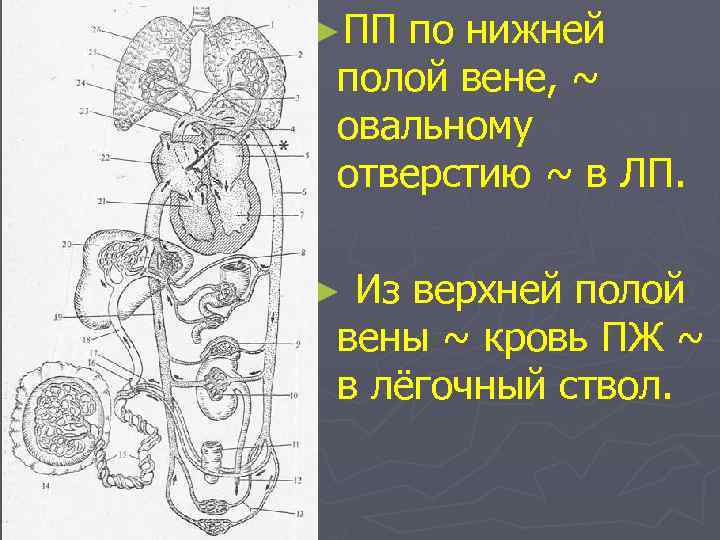 ►ПП по нижней полой вене, ~ овальному отверстию ~ в ЛП. Из верхней полой