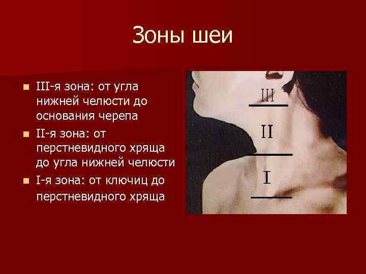 Зоны шеи III-я зона: от угла нижней челюсти до основания черепа n II-я зона: