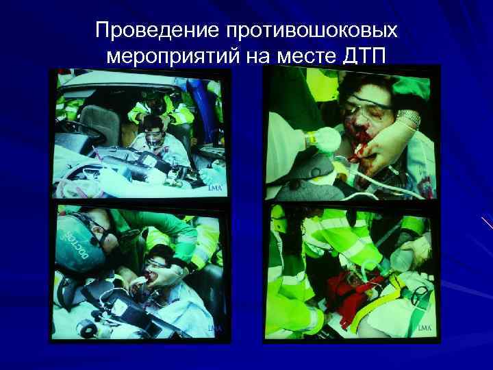 Проведение противошоковых мероприятий на месте ДТП 