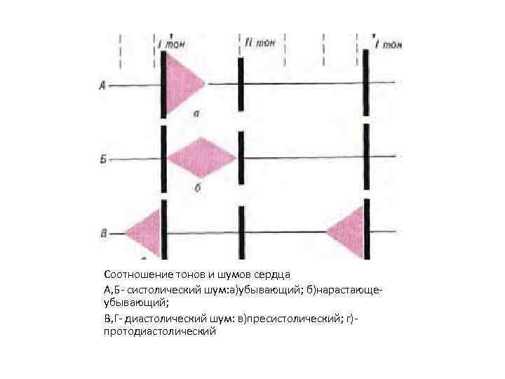 Тоны сердца схема