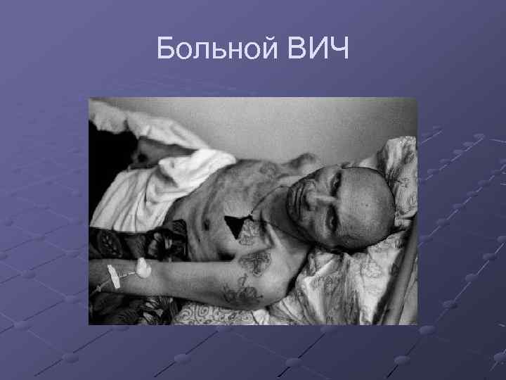Больной ВИЧ 