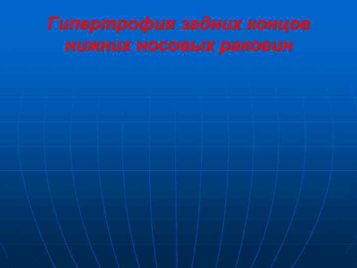 Гипертрофия задних концов нижних носовых раковин 