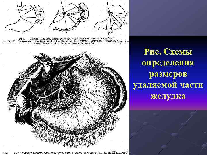 Курс факультетской хирургии в рисунках таблицах и схемах