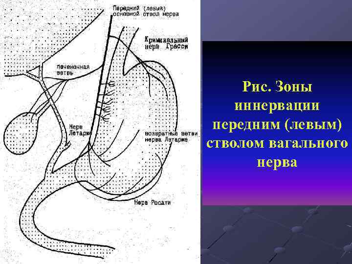 Левый ствол