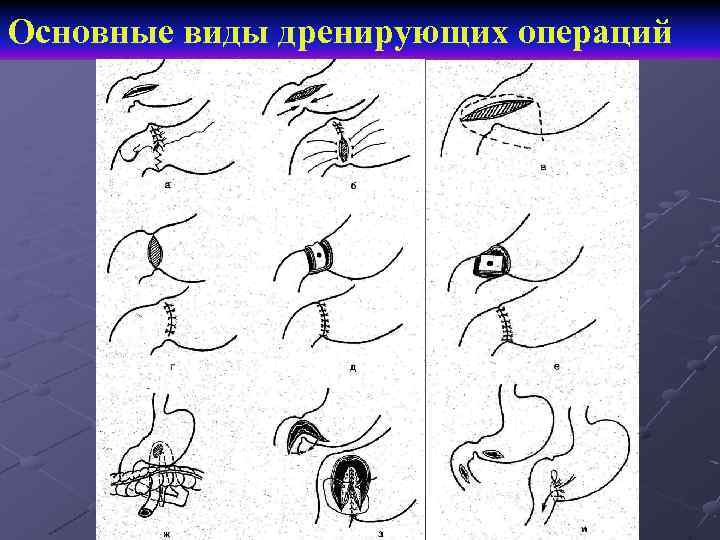 Курс факультетской хирургии в рисунках таблицах и схемах