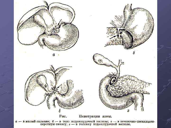 Курс факультетской хирургии в рисунках таблицах и схемах