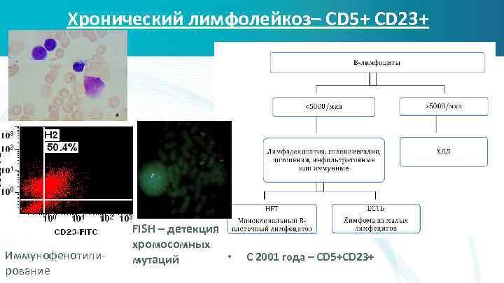 Хронический лимфолейкоз– CD 5+ CD 23+ Иммунофенотипирование FISH – детекция хромосомных • мутаций С