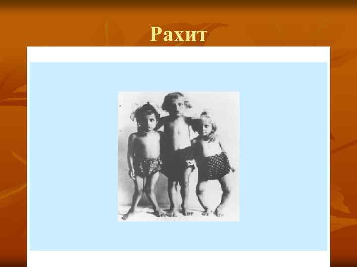 Рахит 