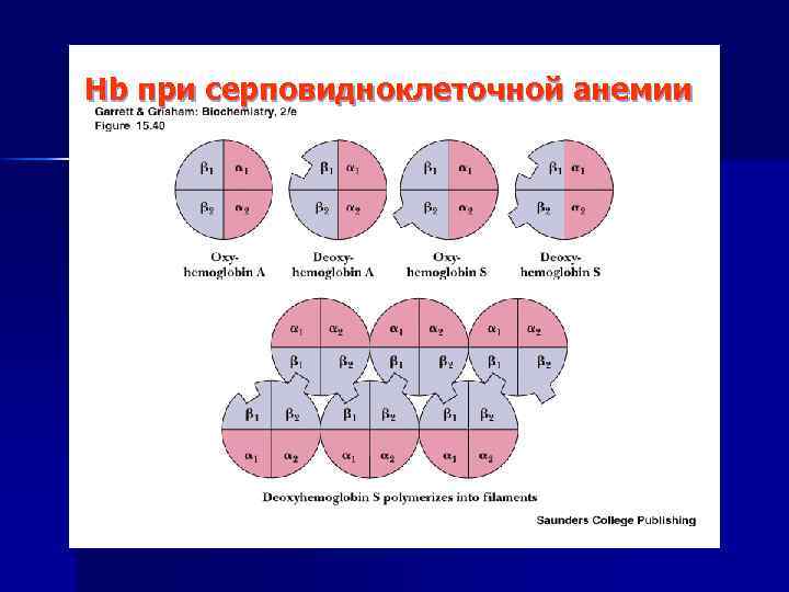 Hb при серповидноклеточной анемии 