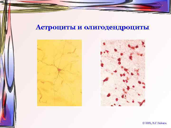 Астроциты и олигодендроциты © 2008, В. Г. Зайцев 