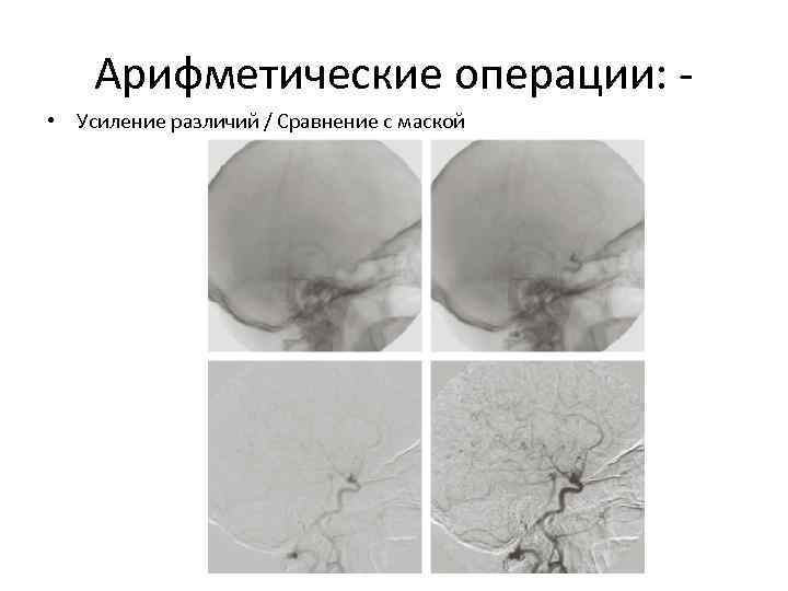 Арифметические операции: • Усиление различий / Сравнение с маской 