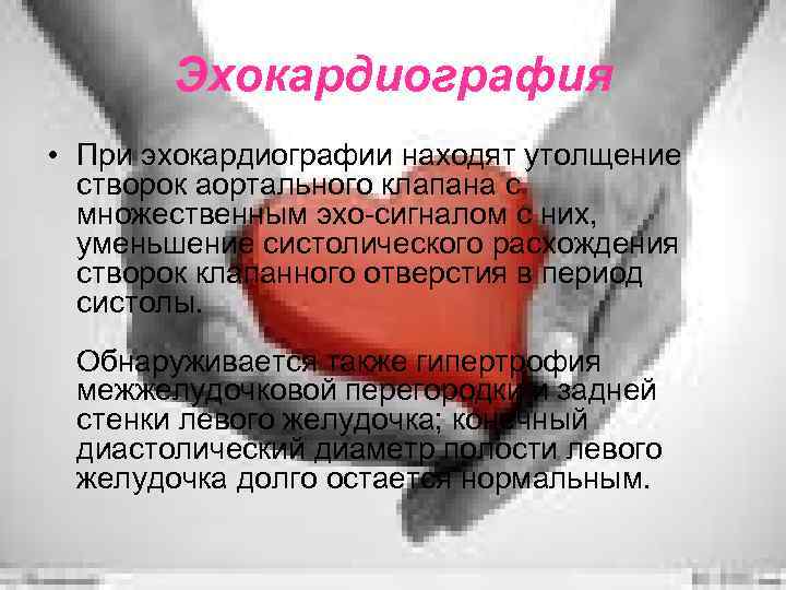 Эхокардиография • При эхокардиографии находят утолщение створок аортального клапана с множественным эхо-сигналом с них,