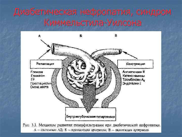 Диабетическая нефропатия, синдром Киммельстила-Уилсона 