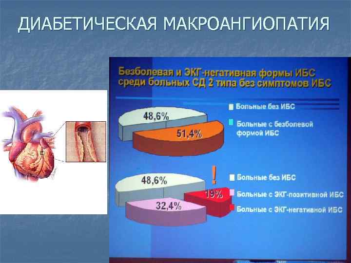 ДИАБЕТИЧЕСКАЯ МАКРОАНГИОПАТИЯ 