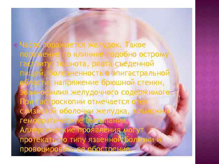  Часто поражается желудок. Такое поражение по клинике подобно острому гастриту: тошнота, рвота съеденной