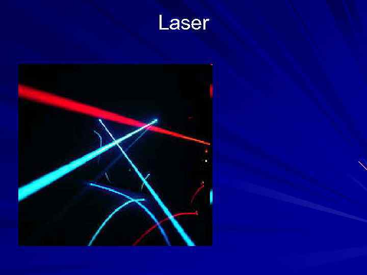 Laser 