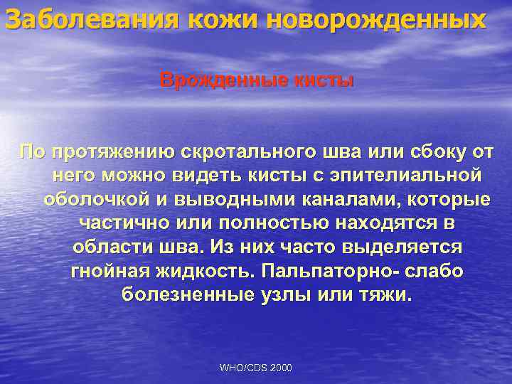 Заболевания кожи новорожденных Врожденные кисты По протяжению скротального шва или сбоку от него можно