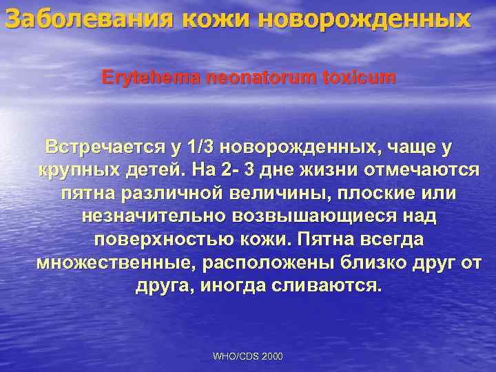 Заболевания кожи новорожденных Erytehema neonatorum toxicum Встречается у 1/3 новорожденных, чаще у крупных детей.