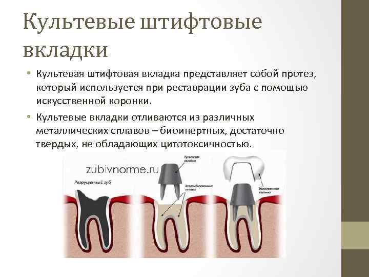 Культевые штифтовые вкладки • Культевая штифтовая вкладка представляет собой протез, который используется при реставрации