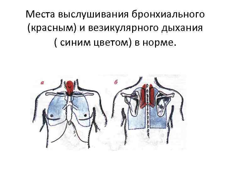 Места выслушивания бронхиального (красным) и везикулярного дыхания ( синим цветом) в норме. 