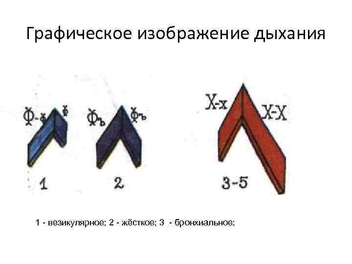 Графическое изображение дыхания 1 - везикулярное; 2 - жёсткое; 3 - бронхиальное; 