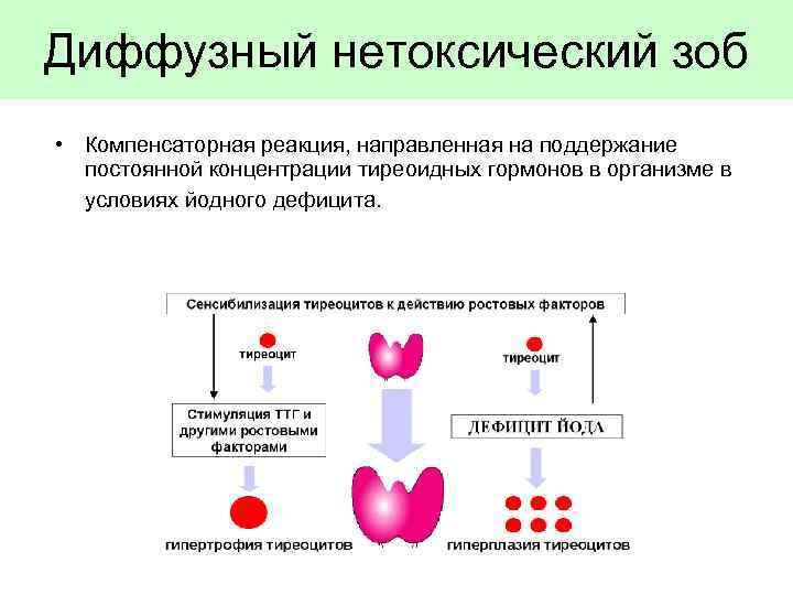 Диффузный нетоксический зоб • Компенсаторная реакция, направленная на поддержание постоянной концентрации тиреоидных гормонов в