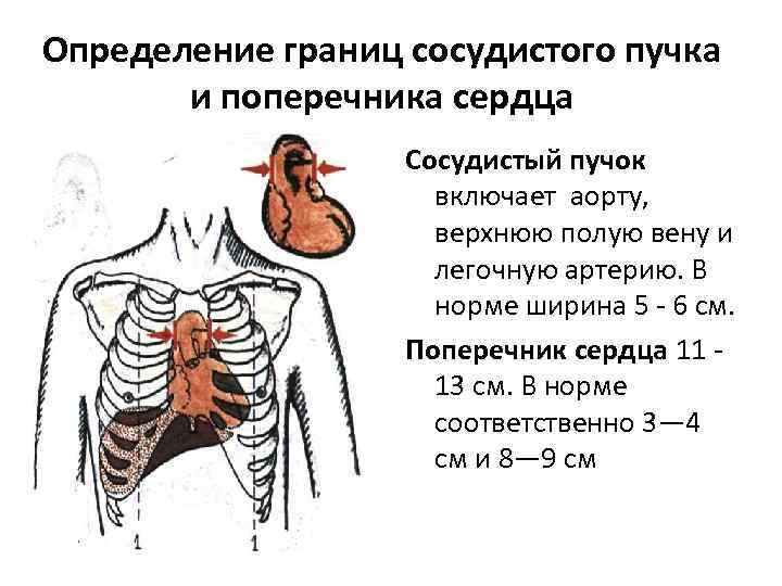 Что такое сосудистые пучки