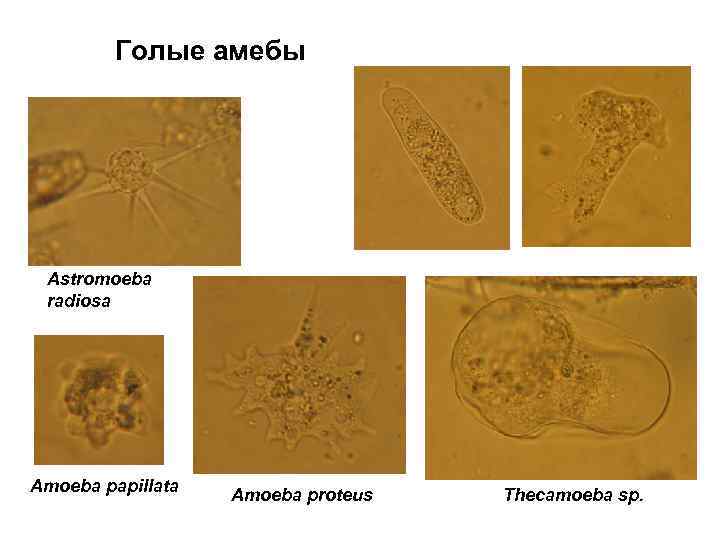 Голые амебы Astromoeba radiosa Amoeba papillata Amoeba proteus Thecamoeba sp. 