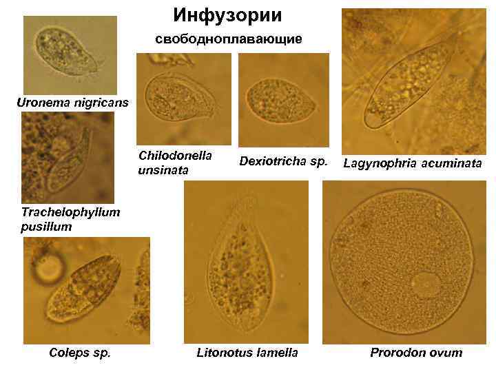 Инфузории свободноплавающие Uronema nigricans Chilodonella unsinata Dexiotricha sp. Lagynophria acuminata Trachelophyllum pusillum Coleps sp.
