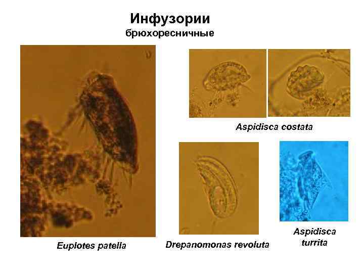 Инфузории брюхоресничные Aspidisca costata Euplotes patella Drepanomonas revoluta Aspidisca turrita 