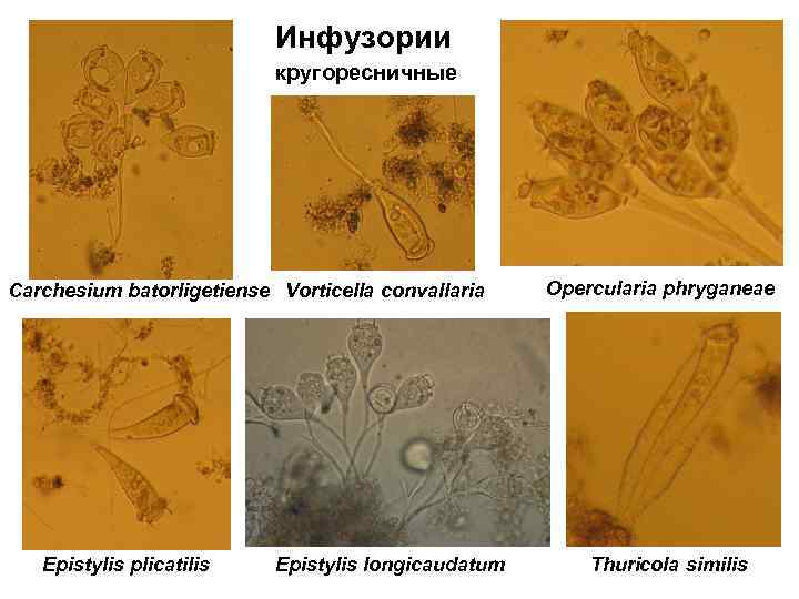 Инфузории кругоресничные Carchesium batorligetiense Vorticella convallaria Epistylis plicatilis Epistylis longicaudatum Opercularia phryganeae Thuricola similis