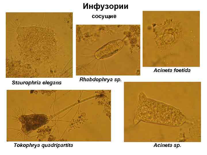 Инфузории сосущие Acineta foetida Staurophria elegans Tokophrya quadripartita Rhabdophrya sp. Acineta sp. 