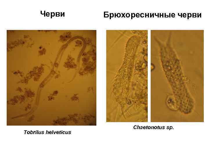 Черви Tobrilus helveticus Брюхоресничные черви Chaetonotus sp. 