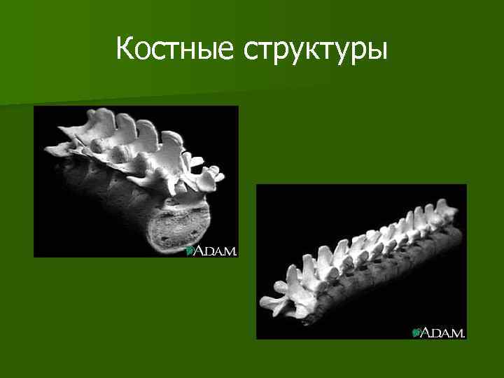 Костные структуры 