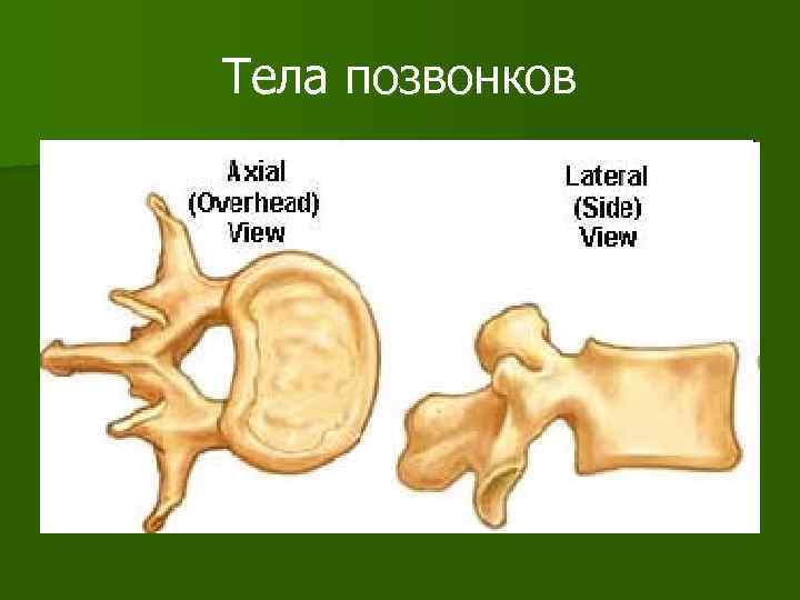 Тела позвонков 