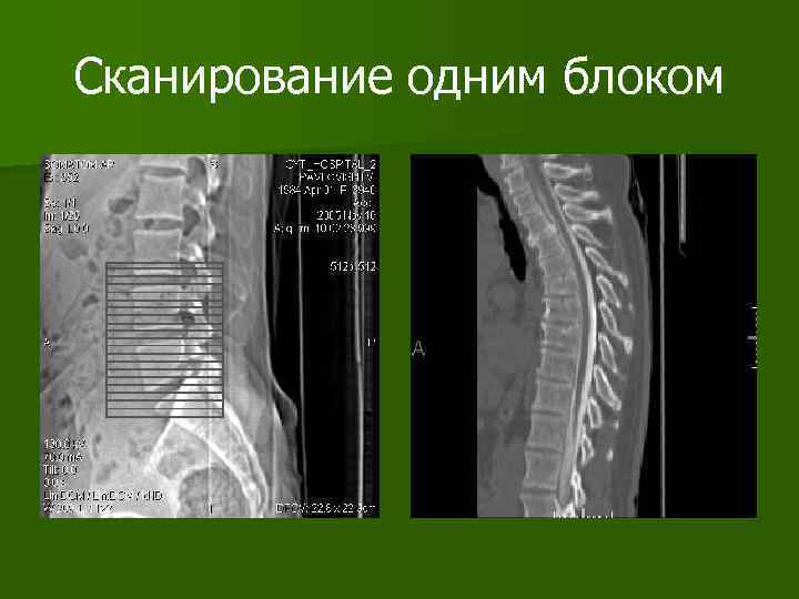 Сканирование одним блоком 