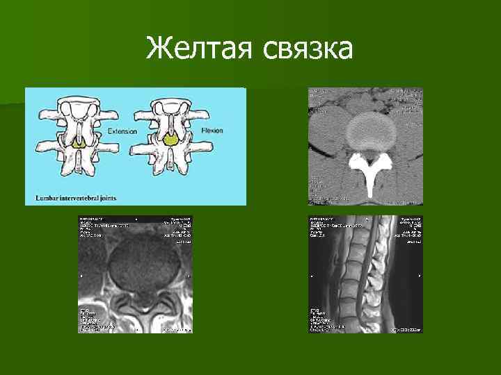Желтая связка 