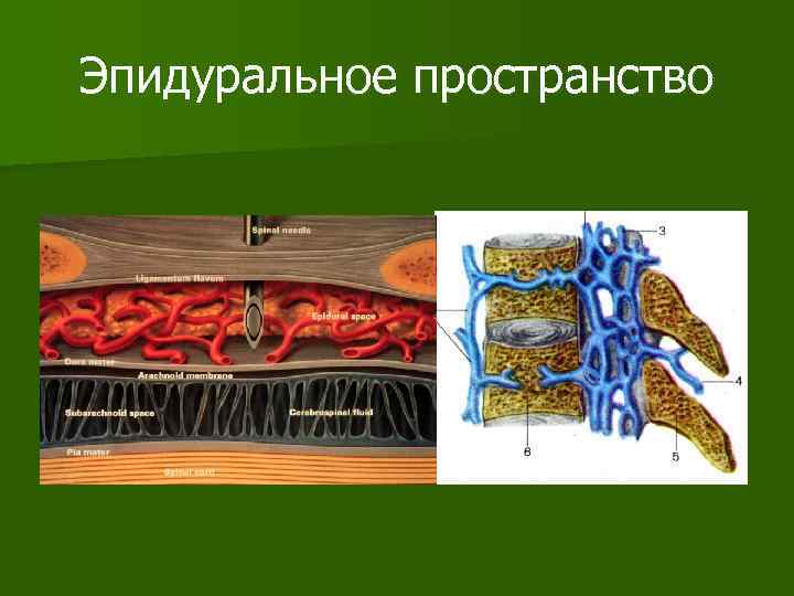 Эпидуральное пространство 