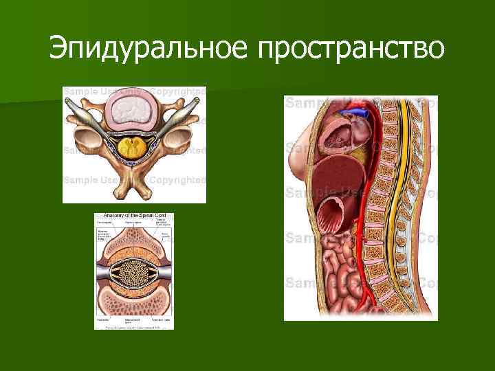 Эпидуральное пространство 
