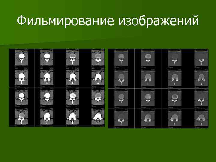 Фильмирование изображений 