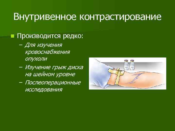 Внутривенное контрастирование n Производится редко: – Для изучения кровоснабжения опухоли – Изучение грыж диска