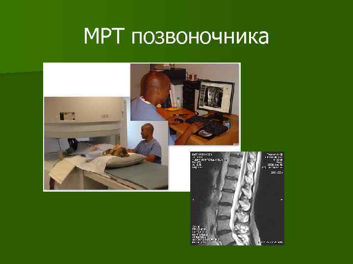 МРТ позвоночника 