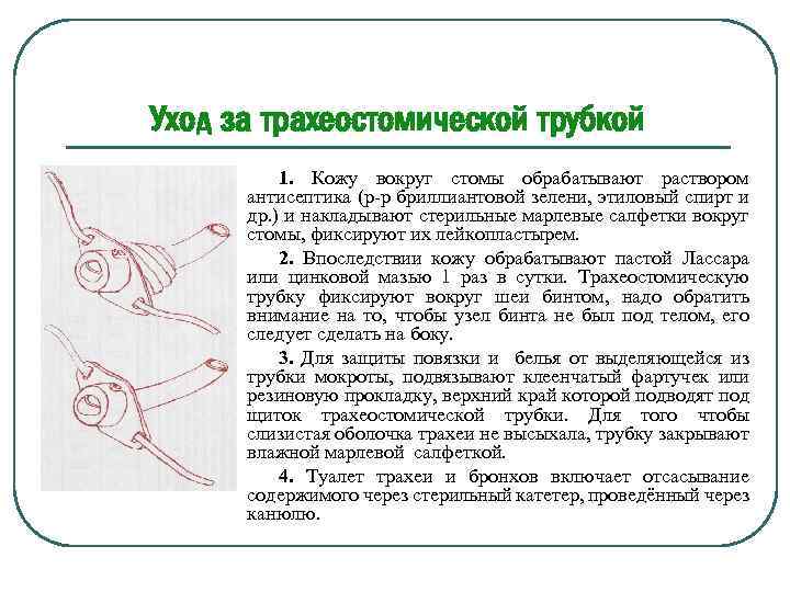 Стомы виды стом уход за стомами презентация