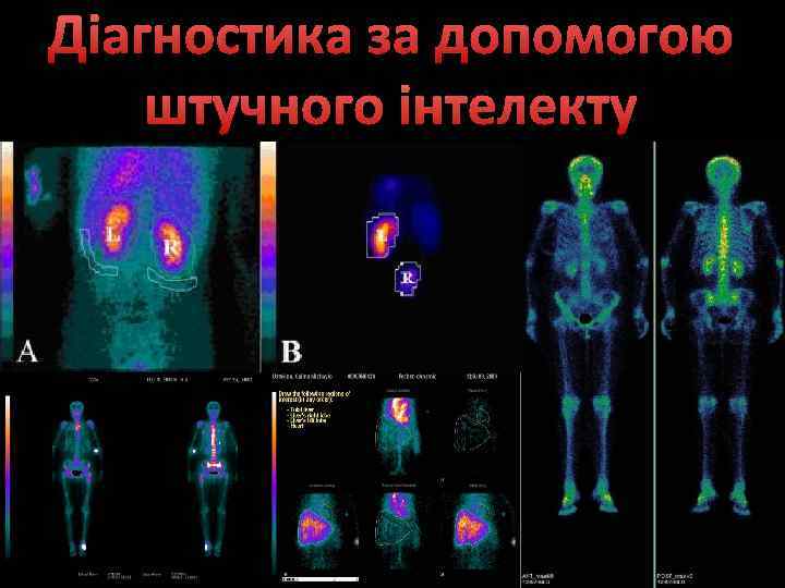 Діагностика за допомогою штучного інтелекту 