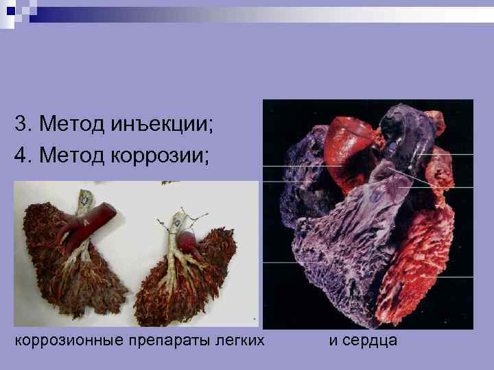 3. Метод инъекции; 4. Метод коррозии; коррозионные препараты легких и сердца 