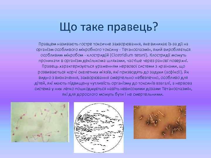 Що таке правець? Правцем називають гостре токсичне захворювання, яке виникає із-за дії на організм