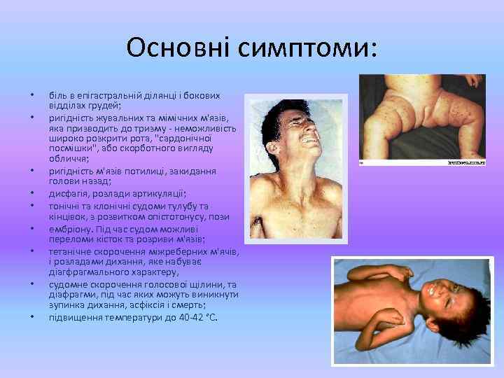 Основні симптоми: • • • біль в епігастральній ділянці і бокових відділах грудей; ригідність