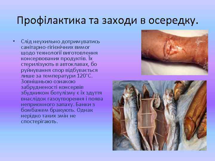 Профілактика та заходи в осередку. • Слід неухильно дотримуватись санітарно-гігієнічних вимог щодо технології виготовлення